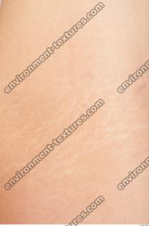 photo texture of scarred skin 0009
